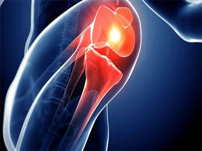Ten Common Knee Joint Diseases